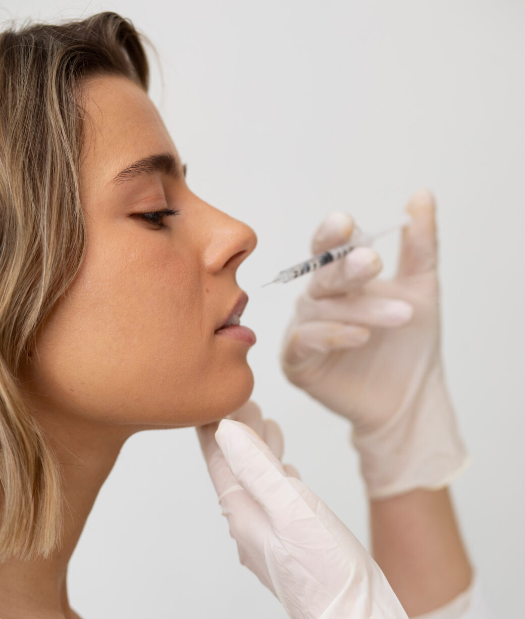 Example: Before and after dermal fillers in Calgary