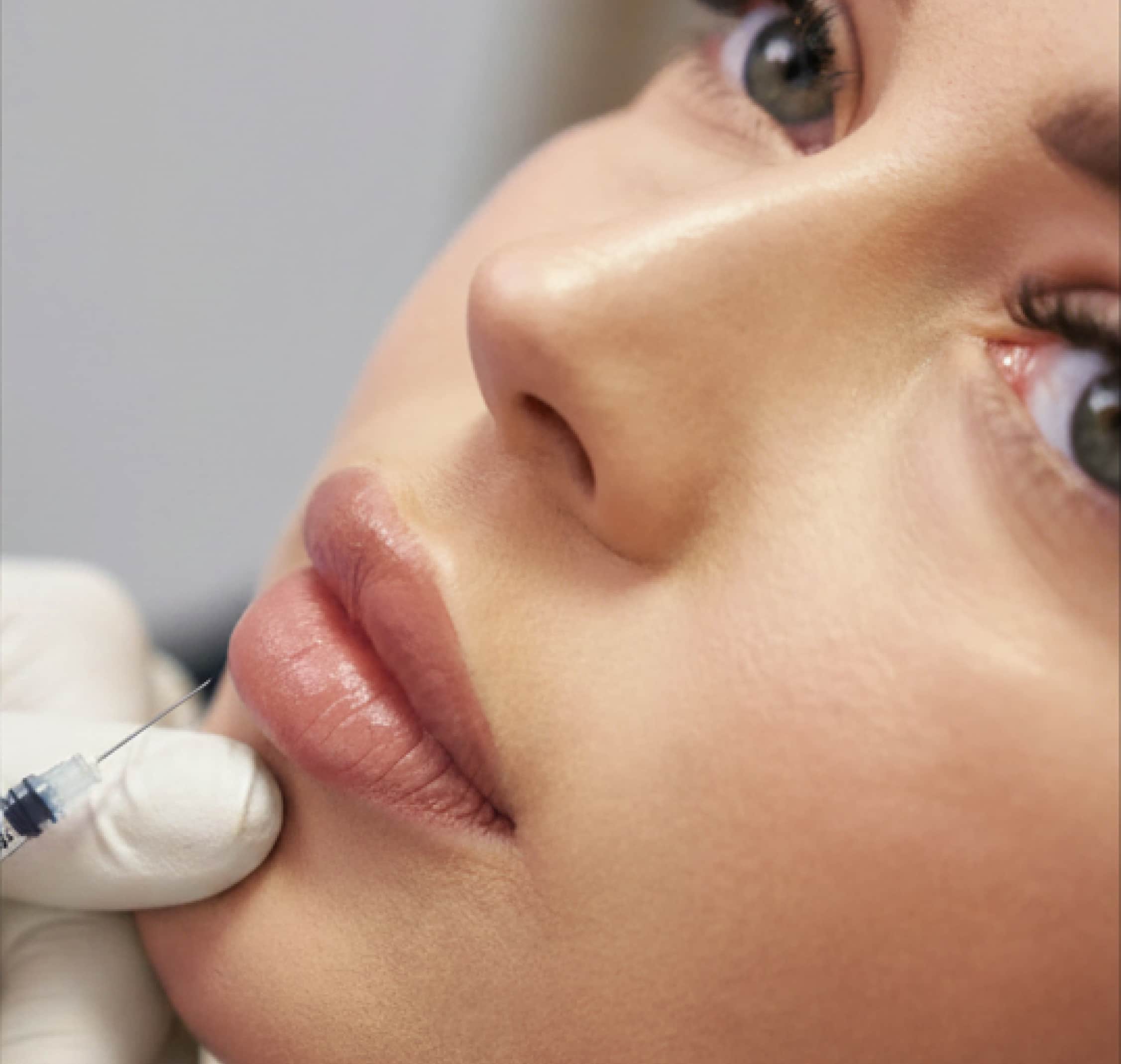 Fillers at SkinCrew Clinic Boca