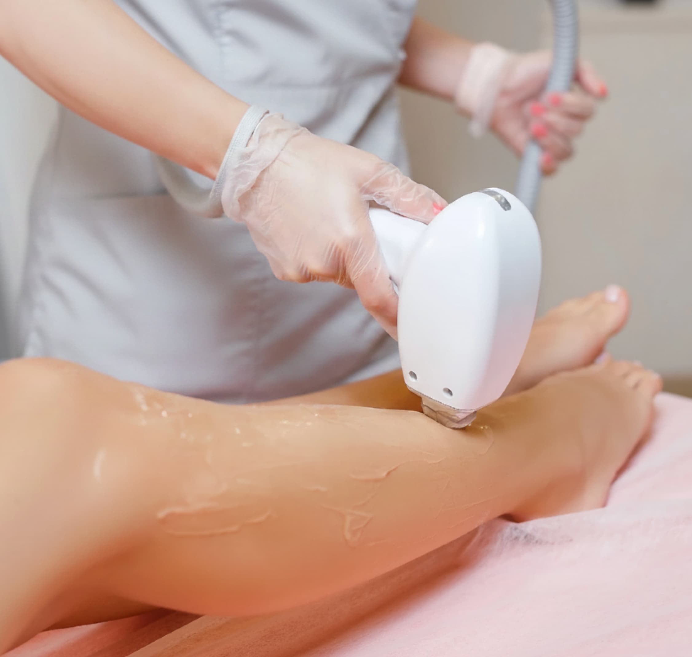 Laser Hair Removal SkinCrew Clinic Boca