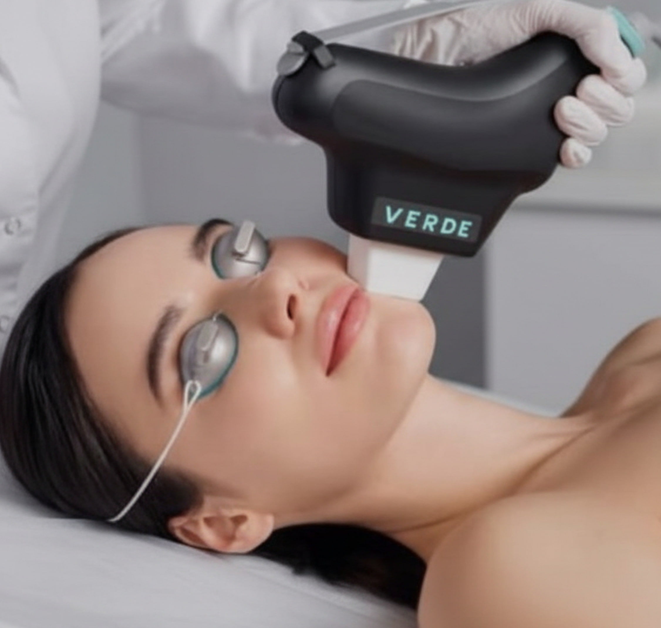 Prisma_IPL_SkinCrew Clinic Boca